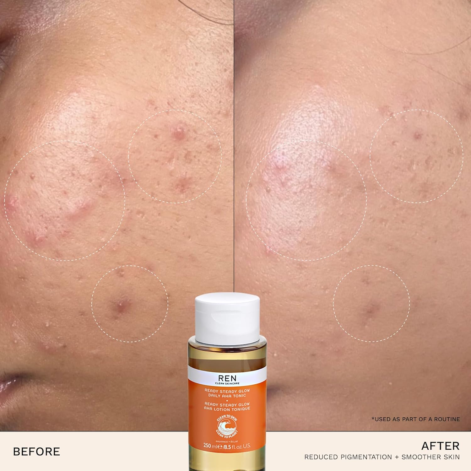 Ren toner Ready Steady Glow Daily AHA Toner