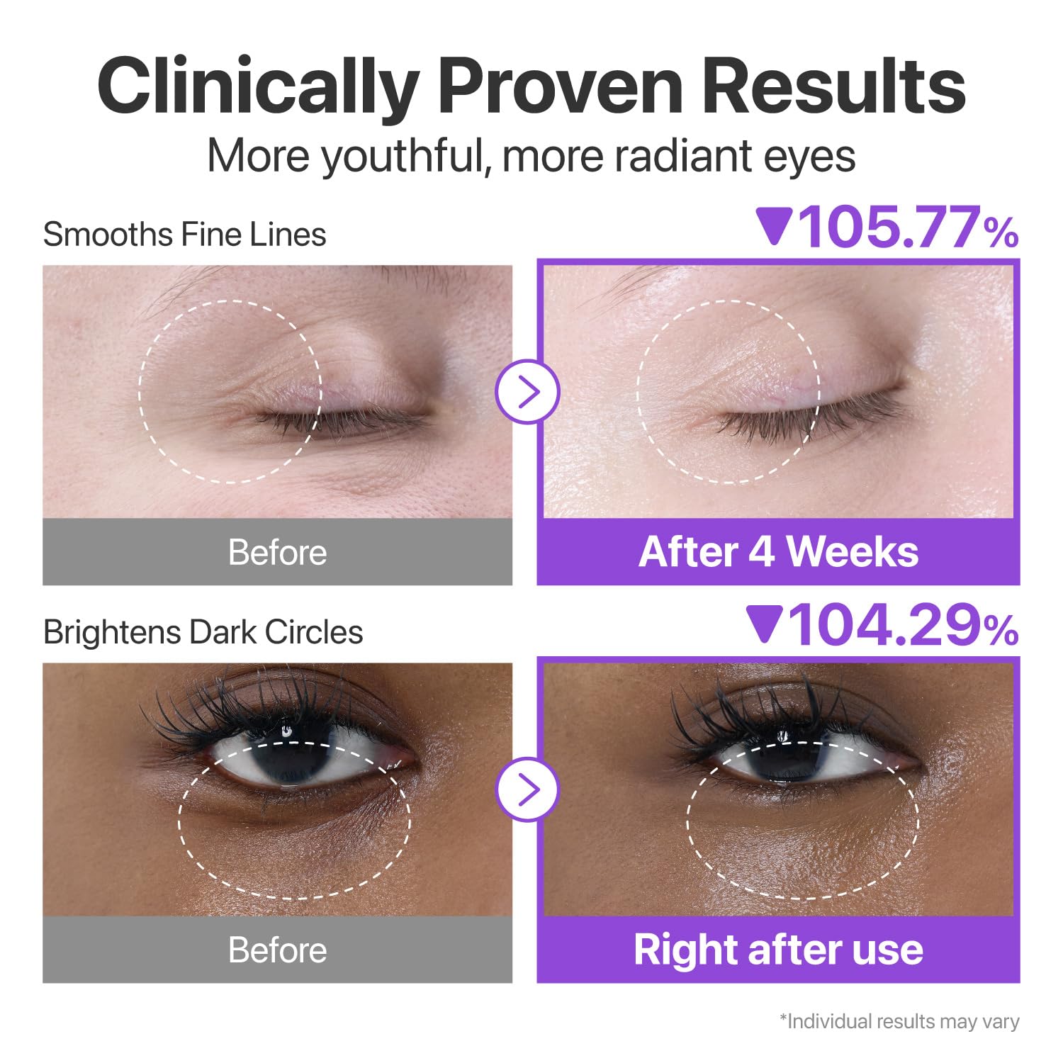 Numbuzin No.9 Eye Cream | NAD+ Retinol Volumetox Eye Serum