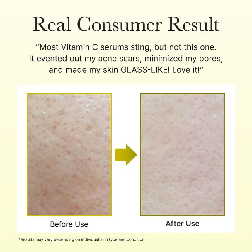Arencia vitamin C booster shot