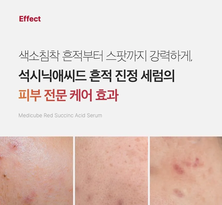 Medicube Red Succinic Acid Serum